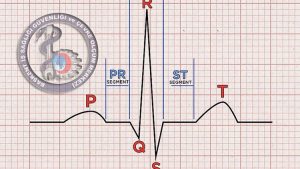 EKG Elektrokardiyogram